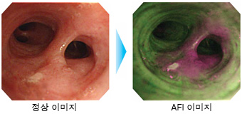 정상 이미지, AFI 이미지